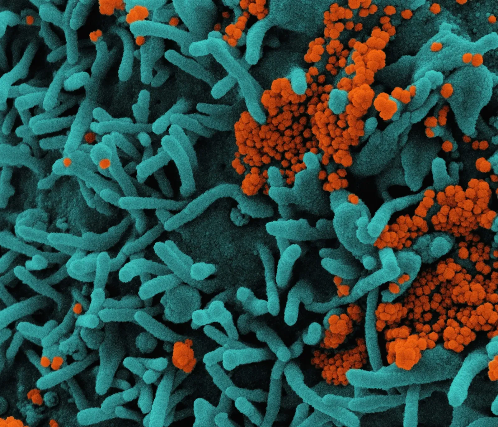 A microscope image of bacteria