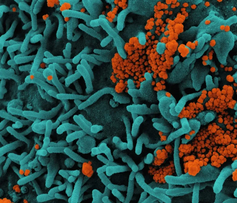 A microscope image of bacteria